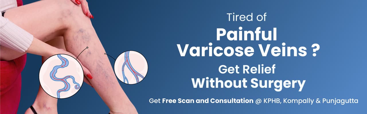 Get non-surgical relief from painful varicose veins at our clinic.