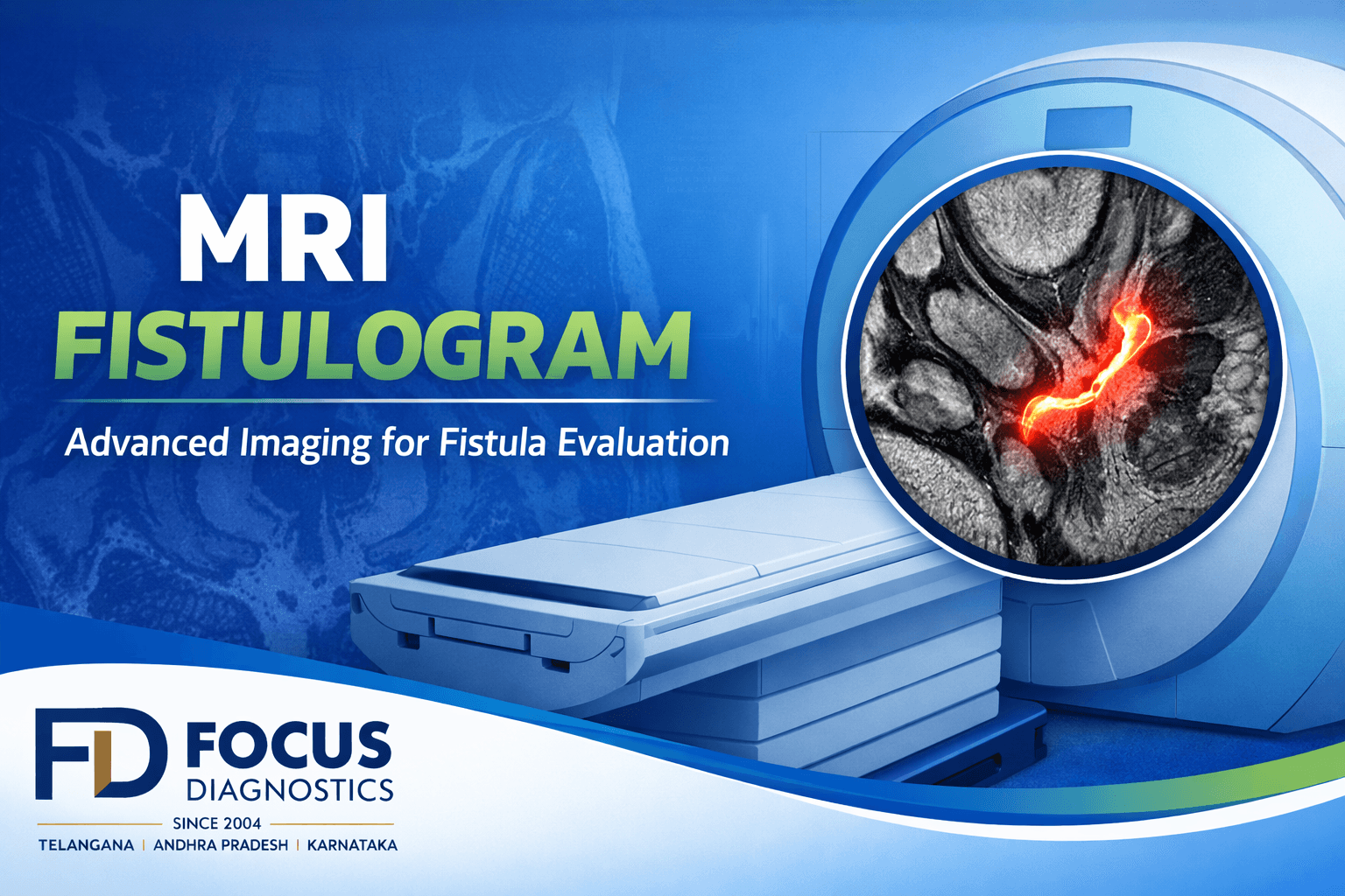 MRI Fistulogram: A Detailed, Non-Invasive Imaging Test for Fistula Evaluation