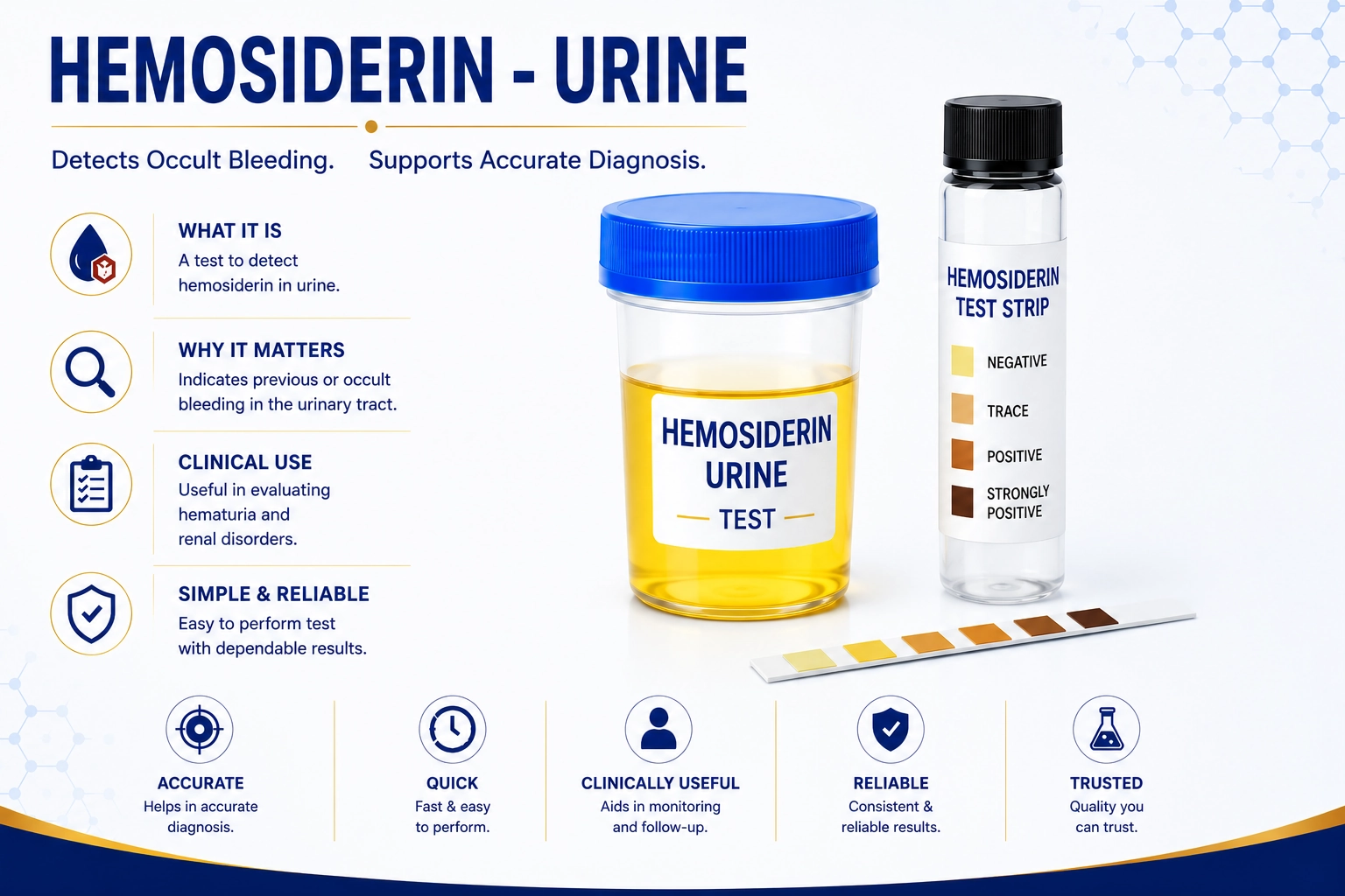 Hemosiderin urine test for hemolytic anemia and urinary iron pigment detection at Focus Diagnostics Hyderabad