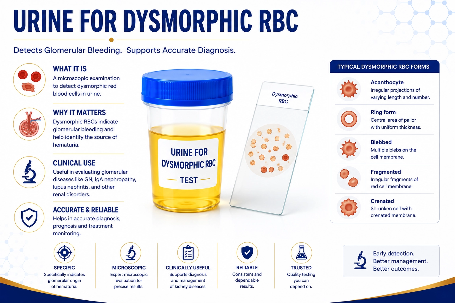 Urine for Dysmorphic RBC test for glomerular kidney disease diagnosis at Focus Diagnostics Hyderabad