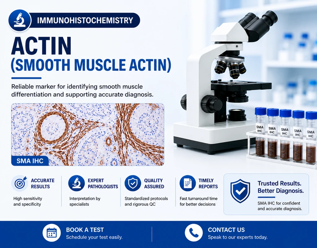 IHC Smooth Muscle Actin (SMA) immunohistochemistry test showing smooth muscle tumor marker staining in tissue sample under microscope