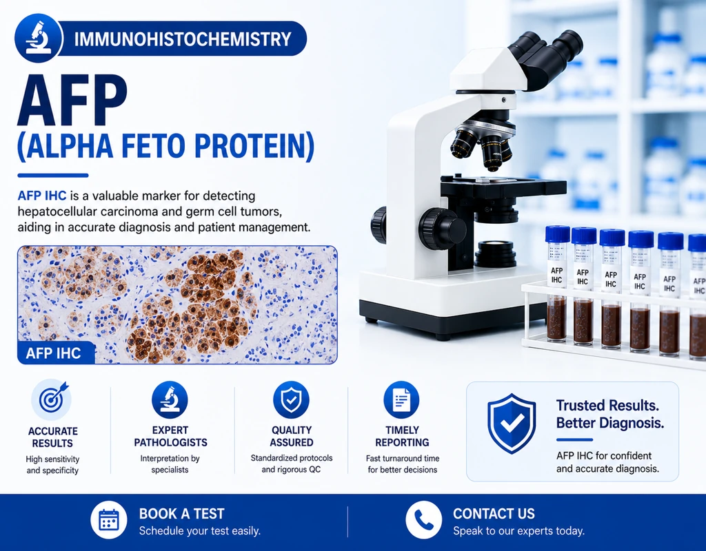 IHC AFP (Alpha Fetoprotein) immunohistochemistry test showing liver and germ cell tumor marker staining in tissue sample under microscope