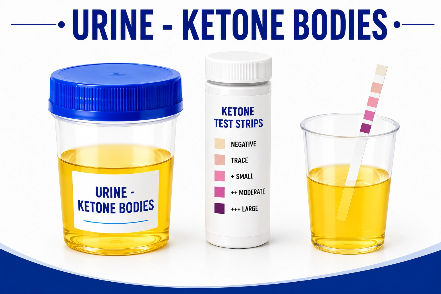 Urine Ketone Bodies test for diabetes monitoring and metabolic health screening at Focus Diagnostics Hyderabad