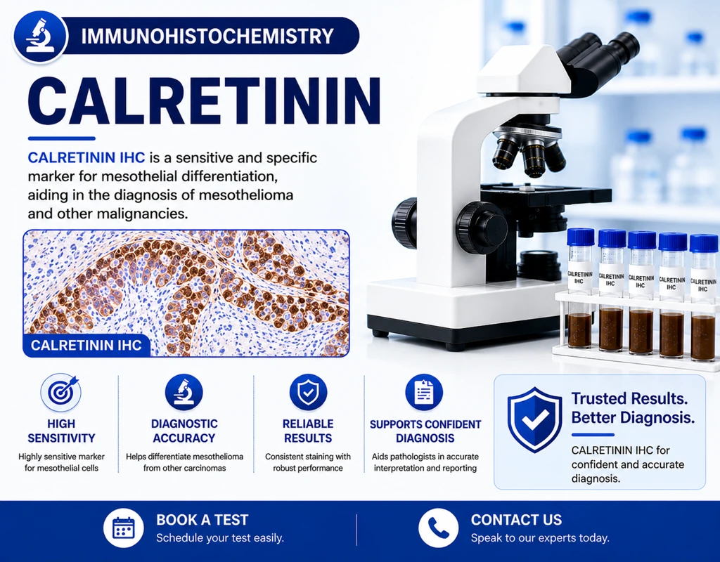 IHC Calretinin immunohistochemistry test showing mesothelioma marker staining in tissue sample under microscope