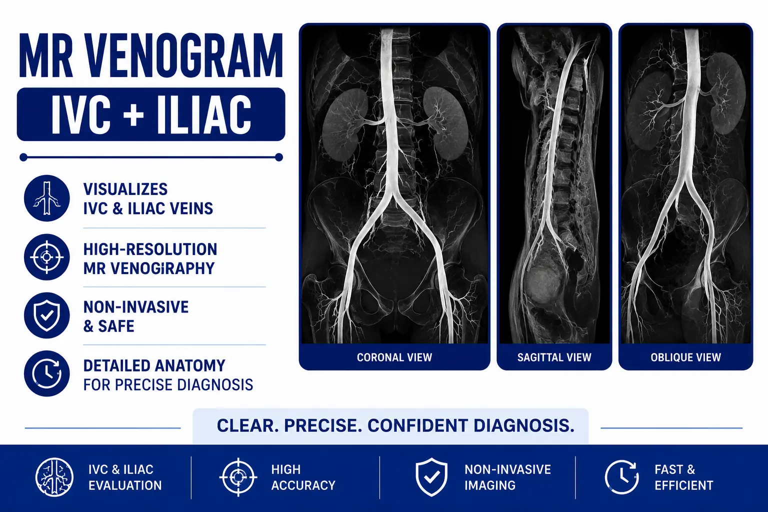MRI Venogram IVC and Iliac Scan at Focus Diagnostics Radiology Department