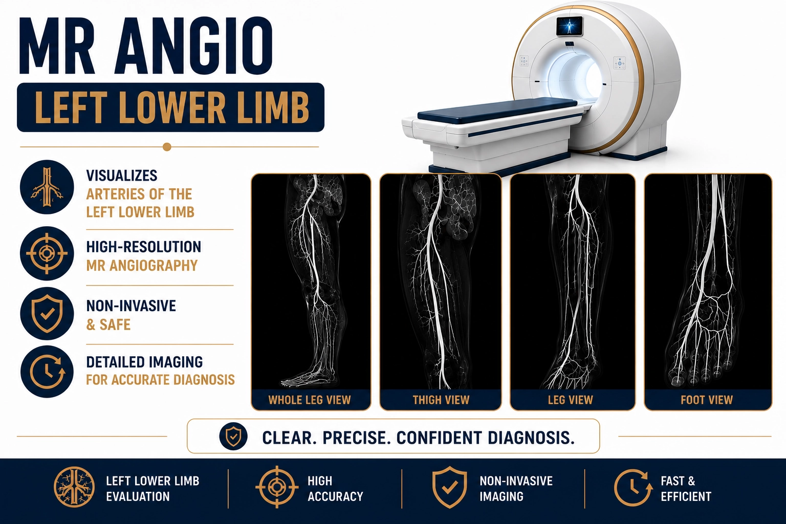 MR Angio Left Lower Limb MRI Scan at Focus Diagnostics Radiology Department