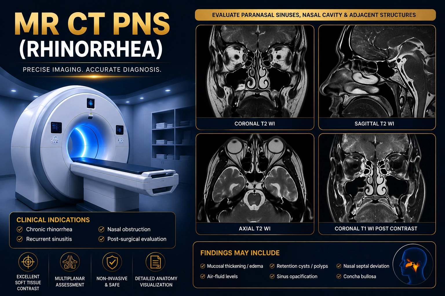 MR CT PNS Rhinorrhea MRI Scan at Focus Diagnostics Radiology Department