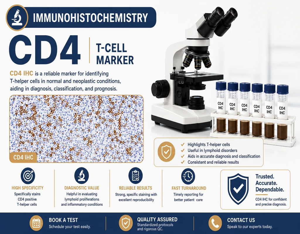 IHC CD4 immunohistochemistry test showing helper T-cell marker staining in lymphoid tissue under microscope