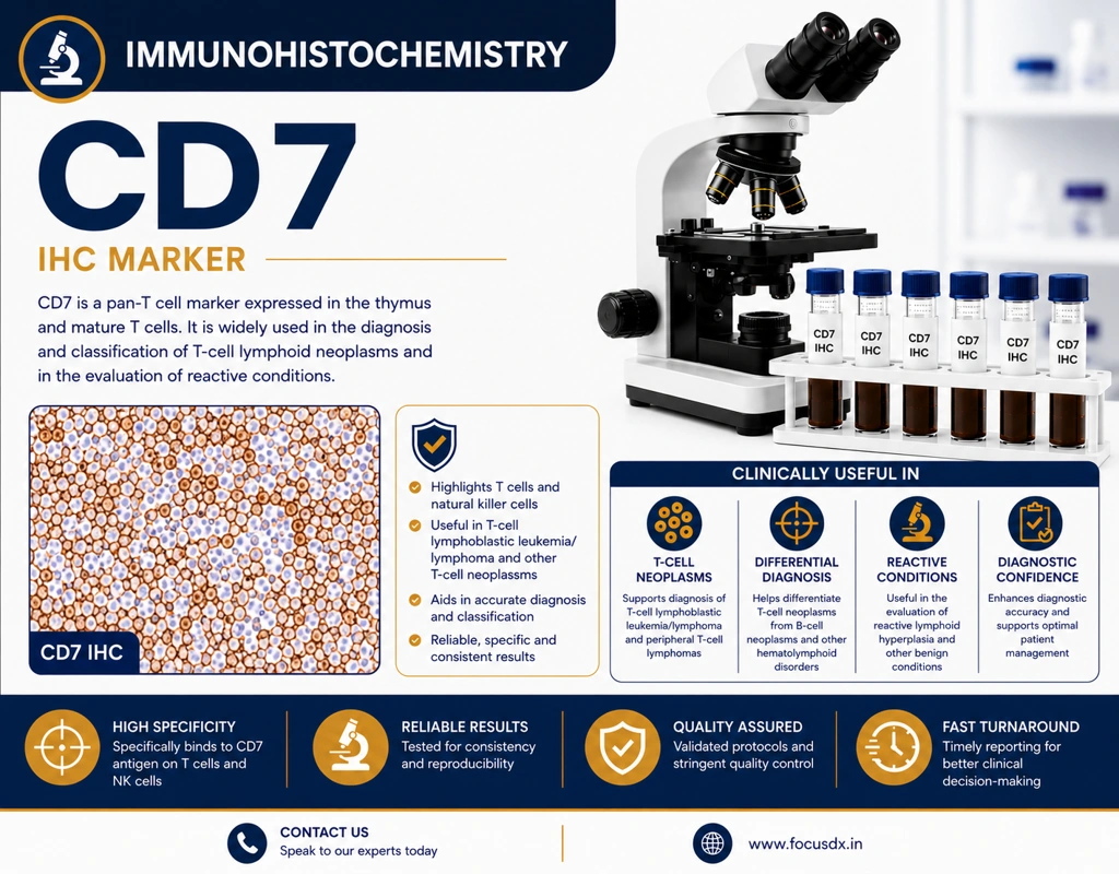 IHC CD7 immunohistochemistry test showing T-cell marker staining in lymphoid tissue under microscope