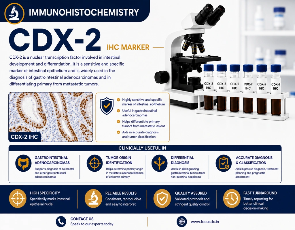 IHC CDX2 immunohistochemistry test showing intestinal epithelial marker staining in colorectal cancer tissue under microscope