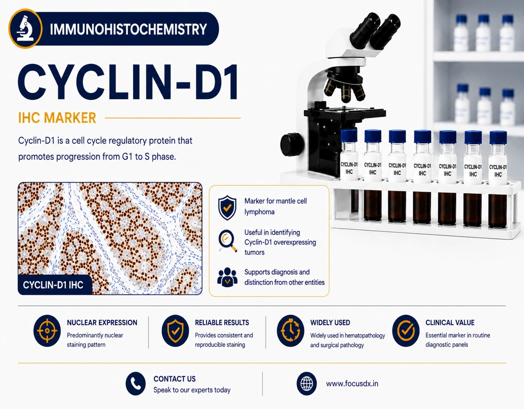 IHC Cyclin D1 immunohistochemistry test showing mantle cell lymphoma marker staining in tissue sample under microscope