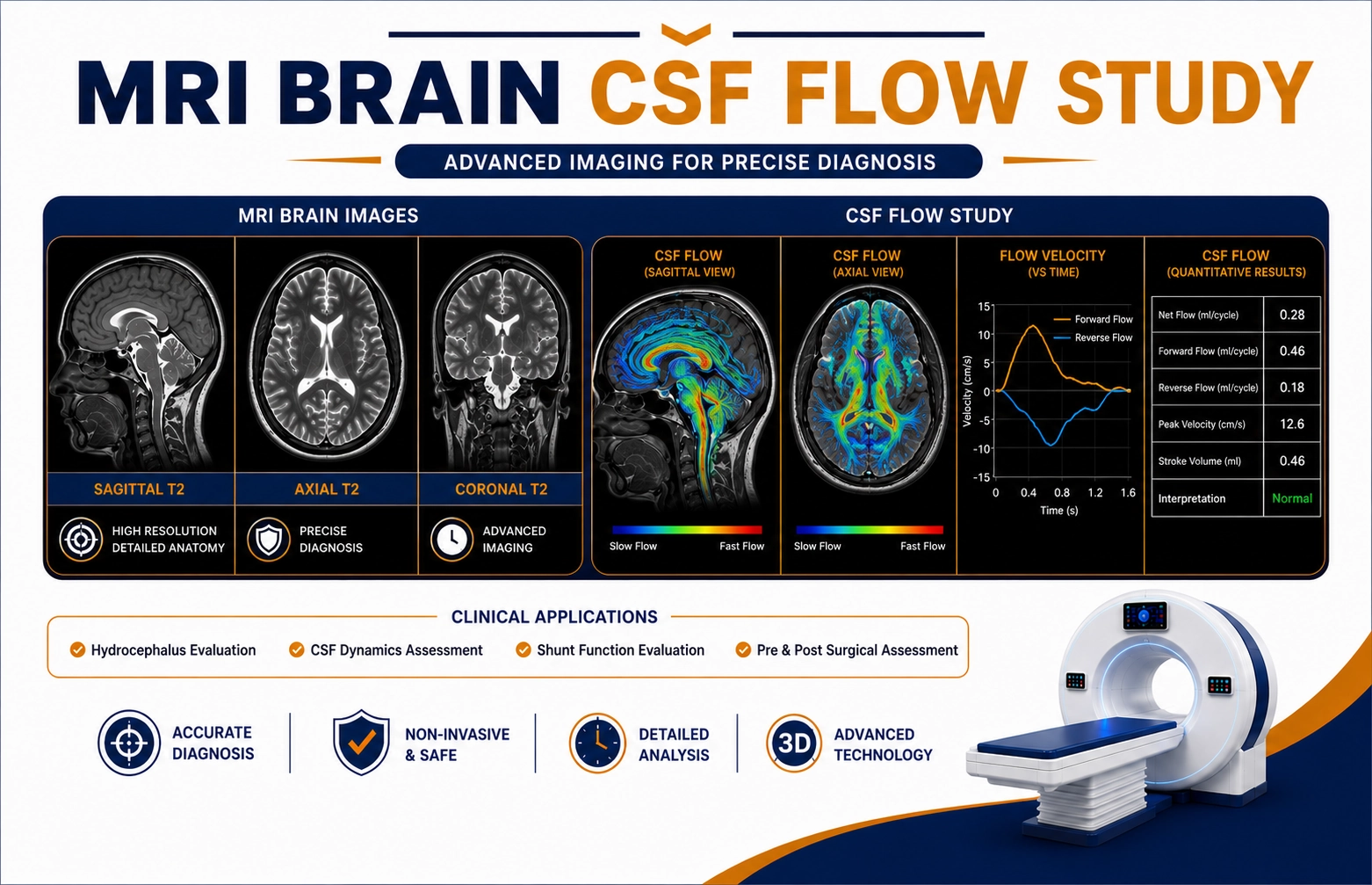 MRI Brain CSF Flow Study scan at Focus Diagnostics Hyderabad showing advanced neurological MRI imaging for cerebrospinal fluid analysis
