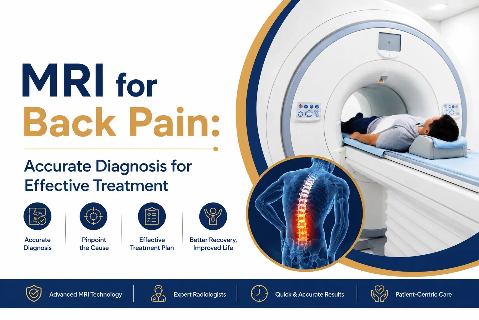 MRI for Back Pain: Accurate Diagnosis for Effective Treatment