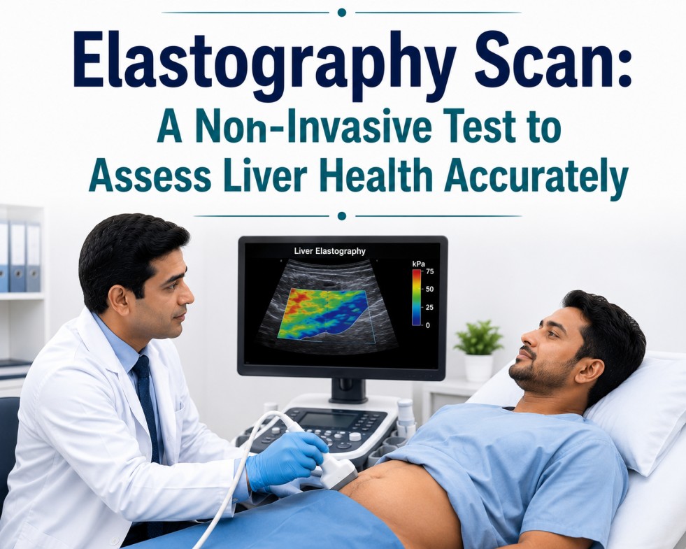 Elastography Scan: A Non-Invasive Test to Assess Liver Health Accurately