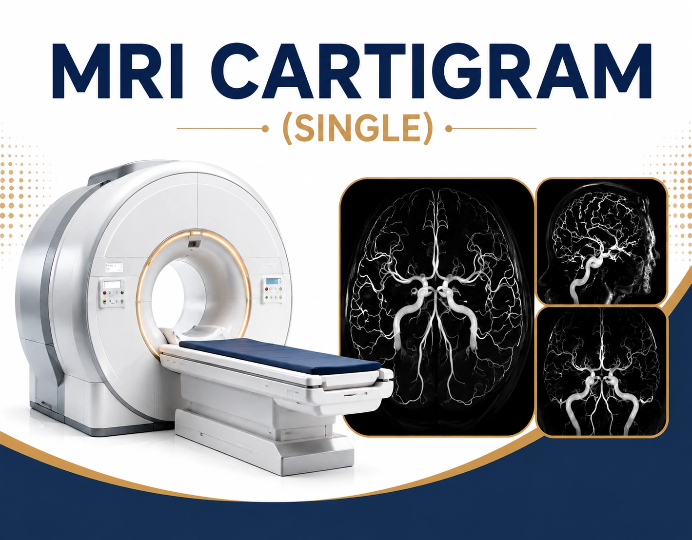 MRI Cartigram single joint scan at Focus Diagnostics showing advanced cartilage mapping and detailed assessment of joint cartilage health