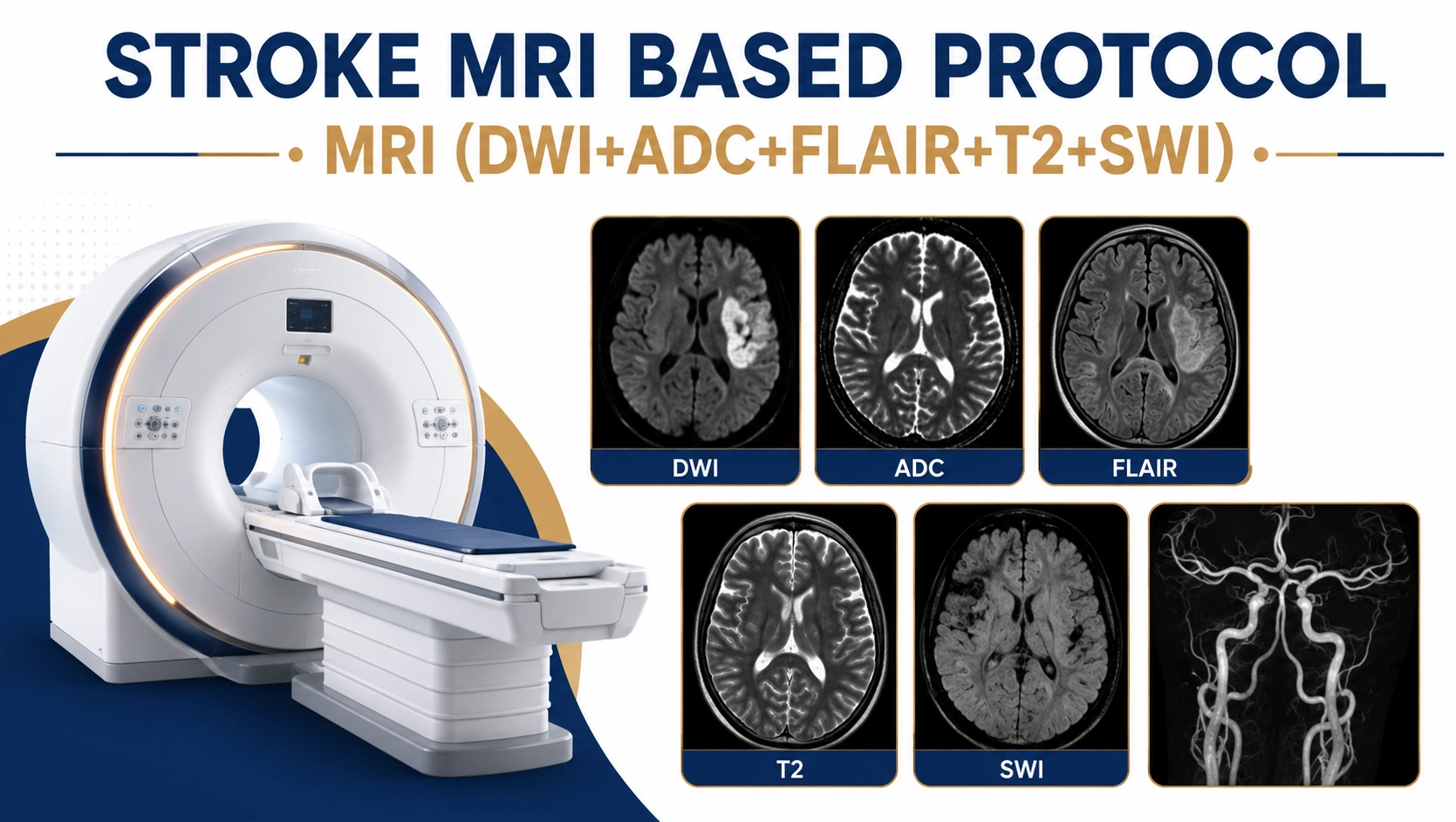Stroke MRI Based Protocol scan showing DWI, ADC, FLAIR, T2 and SWI brain imaging for rapid stroke detection and neurological assessment at Focus Diagnostics