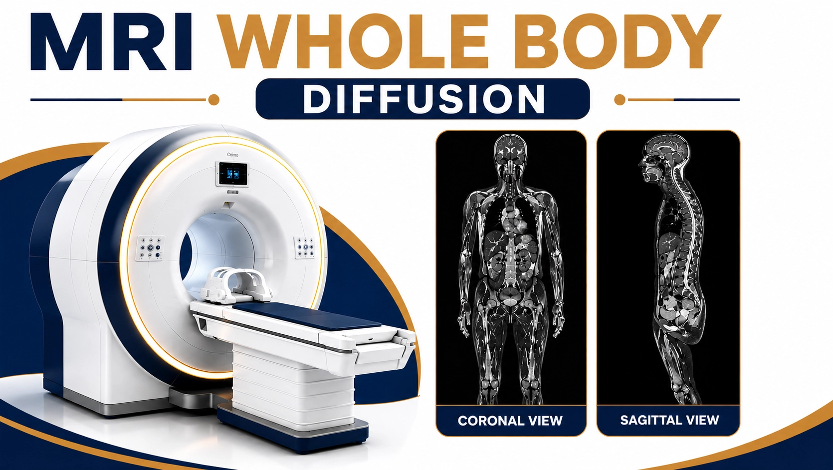 MRI Whole Body Diffusion scan for advanced cancer screening, tumor detection, metastasis evaluation, inflammation assessment, and comprehensive body imaging at Focus Diagnostics