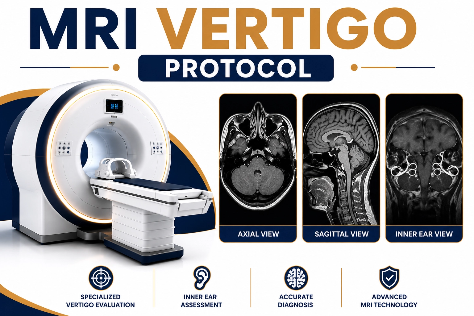 MRI Vertigo Protocol scan for evaluation of dizziness, vertigo, balance disorders, inner ear abnormalities, brain lesions, and neurological conditions at Focus Diagnostics