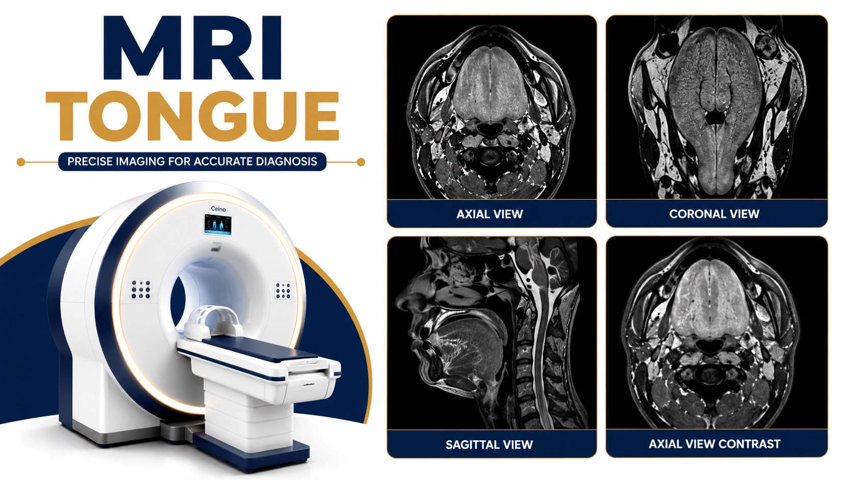 MRI Tongue scan for evaluation of tongue lesions, tumors, infections, inflammation, speech disorders, and oral cavity abnormalities at Focus Diagnostics