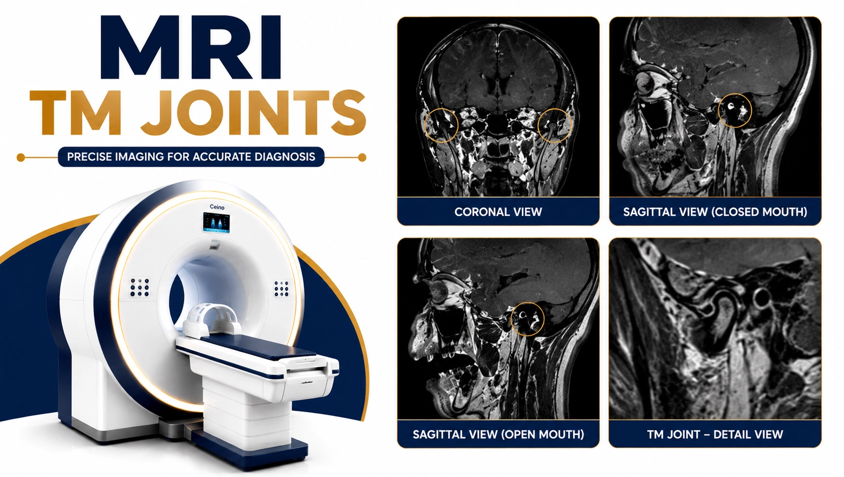 MRI TM Joints scan for evaluation of temporomandibular joint disorders, jaw pain, disc displacement, arthritis, and TMJ dysfunction at Focus Diagnostics