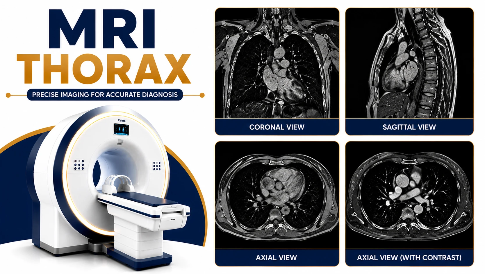 MRI Thorax scan for evaluation of chest wall abnormalities, mediastinal masses, tumors, infections, and thoracic soft tissue disorders at Focus Diagnostics