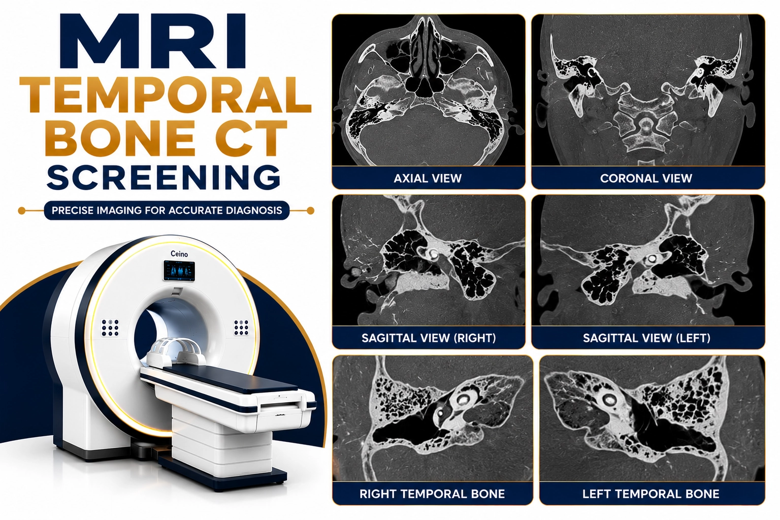 MRI Temporal Bone CT Screening for evaluation of hearing loss, inner ear disorders, temporal bone abnormalities, dizziness, and ear-related conditions at Focus Diagnostics
