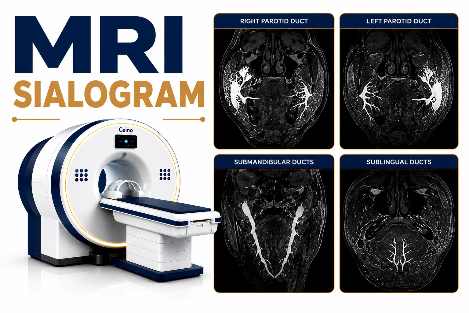 MRI Sialogram scan for evaluation of salivary gland disorders, salivary duct obstruction, stones, inflammation, and gland abnormalities at Focus Diagnostics