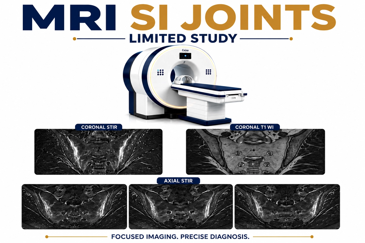 MRI SI Joints Limited Study scan for focused evaluation of sacroiliac joint inflammation, sacroiliitis, arthritis, lower back pain, and pelvic disorders at Focus Diagnostics