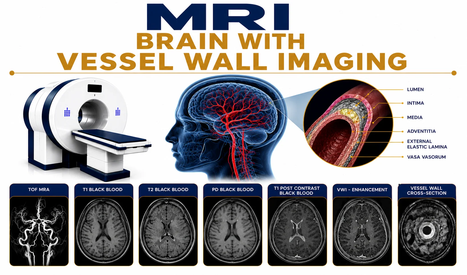 MRI Brain Plain Full Study scan at Focus Diagnostics for detailed neurological brain imaging and accurate diagnosis