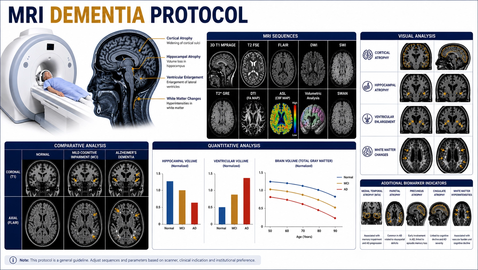 MRI Dementia Protocol brain scan for memory loss and cognitive decline assessment at Focus Diagnostics
