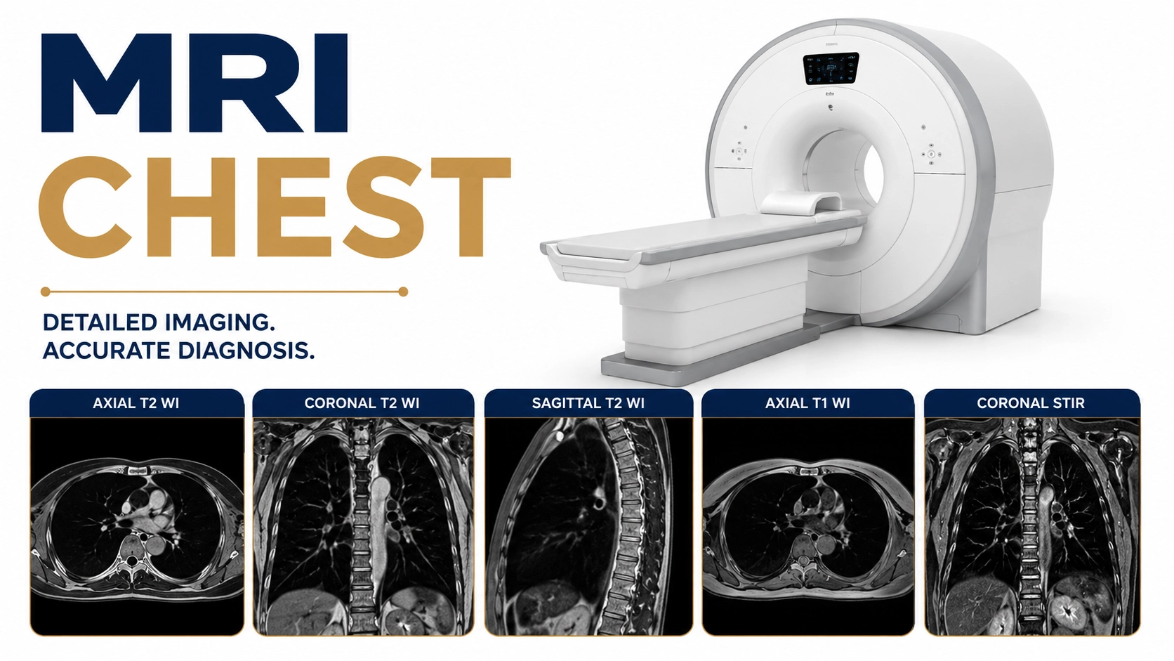 MRI Chest scan at Focus Diagnostics showing detailed imaging of thoracic organs, mediastinum, chest wall, blood vessels, and surrounding soft tissues