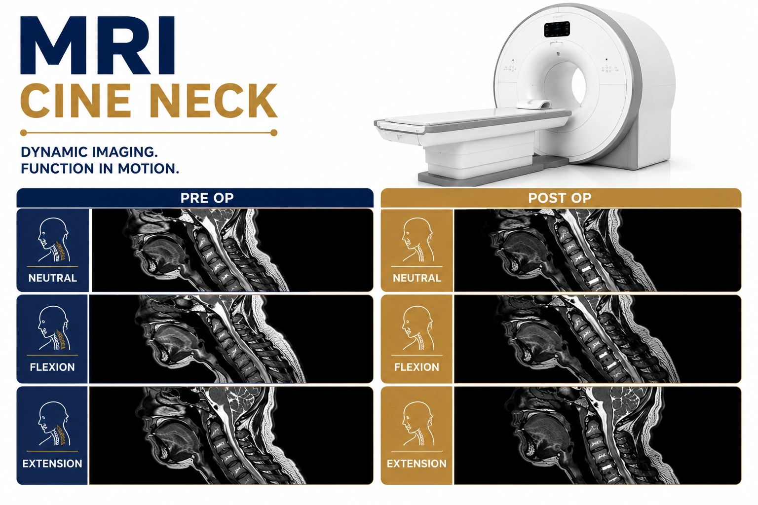 MRI Cine Neck (Pre OP and Post OP) scan at Focus Diagnostics Hyderabad for advanced dynamic neck and post-surgical imaging evaluation