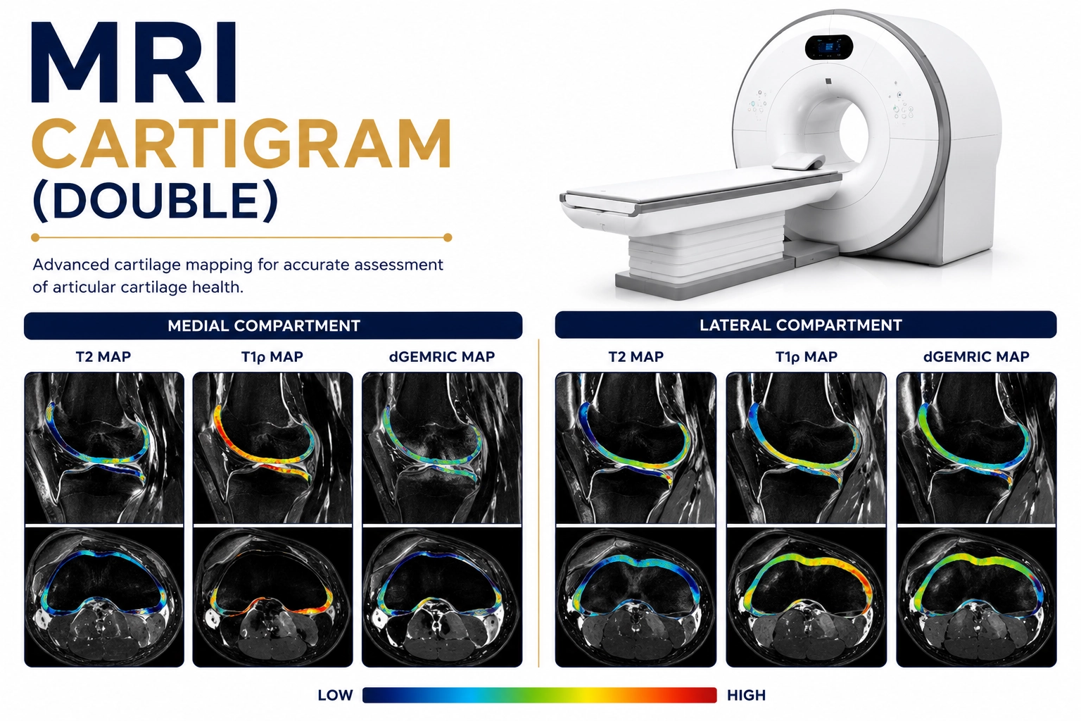 MRI Cartigram Double Joint scan at Focus Diagnostics showing advanced cartilage mapping and detailed evaluation of cartilage health in two joints