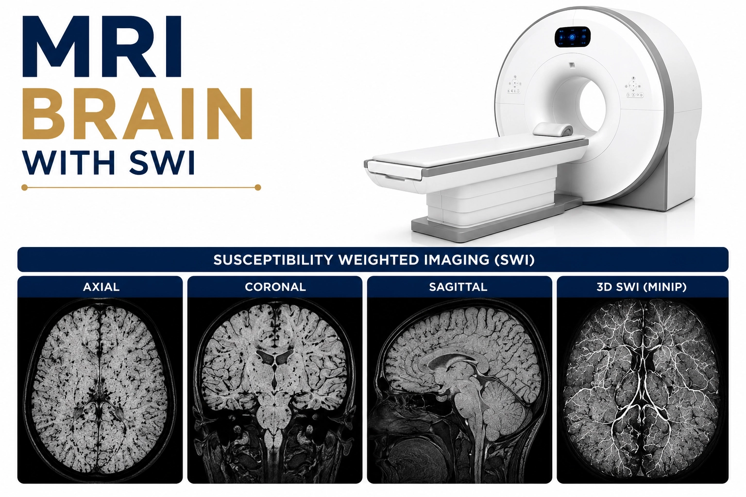 MRI Brain with SWI Scan at Focus Diagnostics – Advanced Brain Imaging for Stroke, Microbleeds and Neurological Disorders