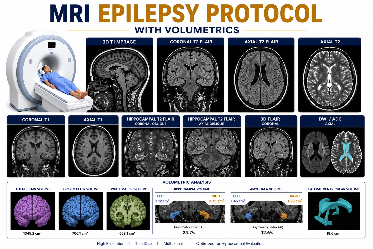 MRI Epilepsy Protocol with Volumetrics scan at Focus Diagnostics for advanced seizure evaluation and brain volume analysis