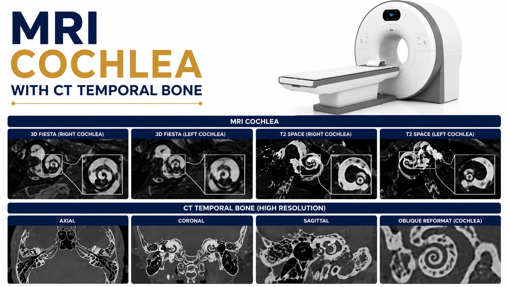 MRI Cochlea with CT Temporal Bone scan at Focus Diagnostics showing detailed imaging of the inner ear, cochlea, auditory nerves, and temporal bone structures
