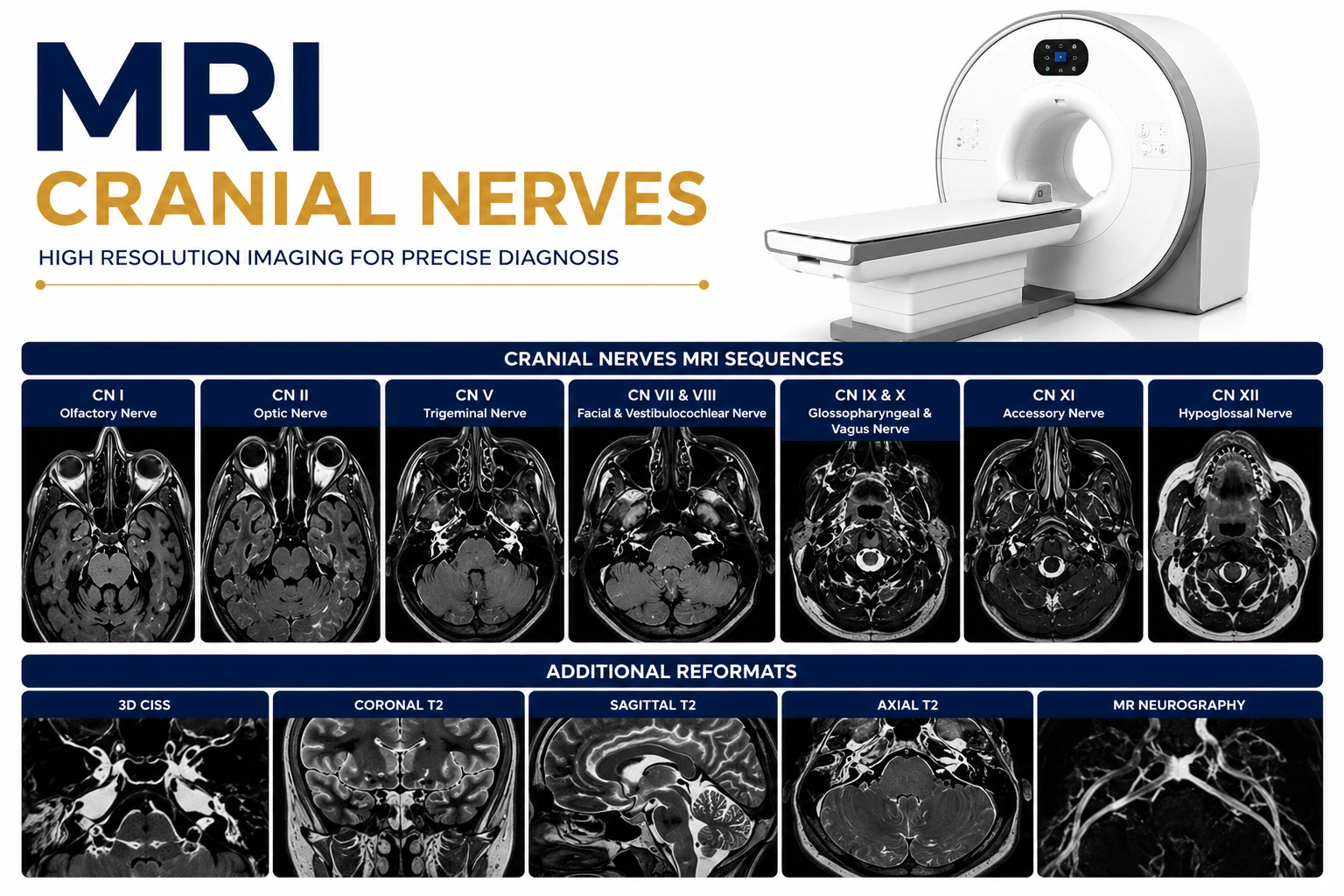 MRI Cranial Nerves scan at Focus Diagnostics showing detailed imaging of cranial nerves and neurological structures of the brain