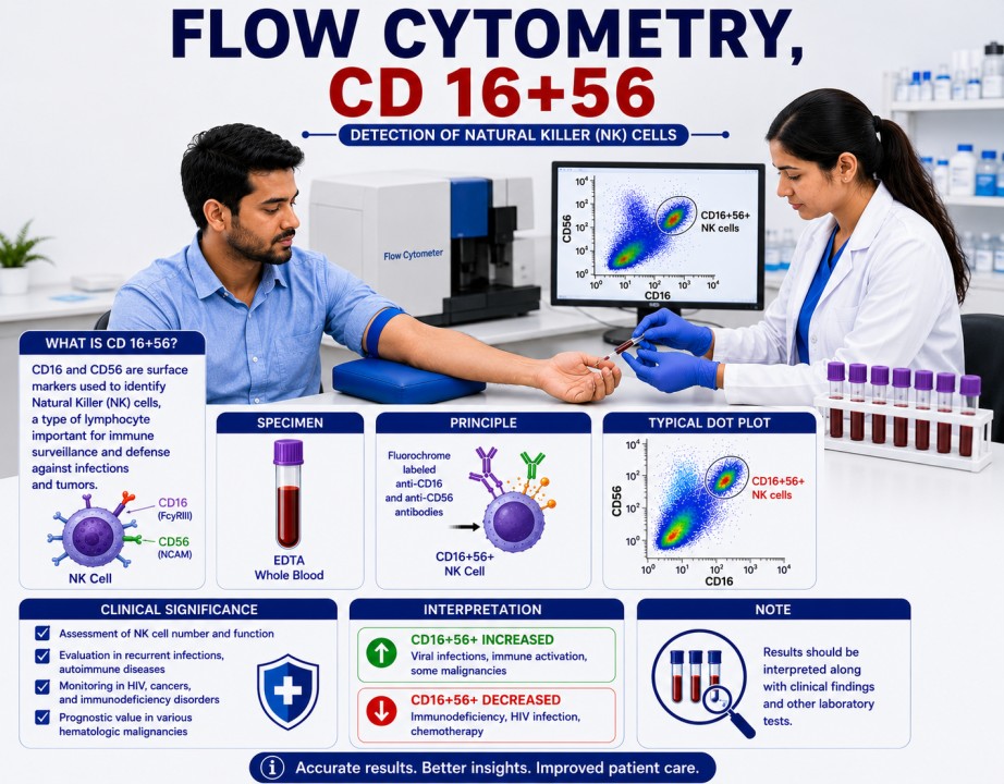 Flow Cytometry CD16+56 test showing Natural Killer (NK) cell immunophenotyping for immune system evaluation and hematological assessment