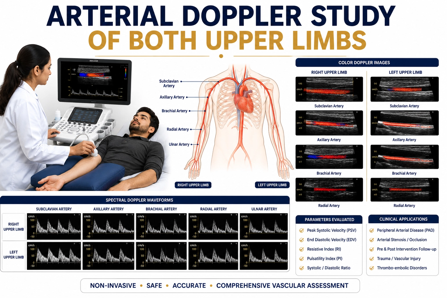 Arterial Doppler Study of Both Upper Limbs for evaluation of arterial blood flow, vascular blockages, circulation disorders, and upper limb artery health at Focus Diagnostics