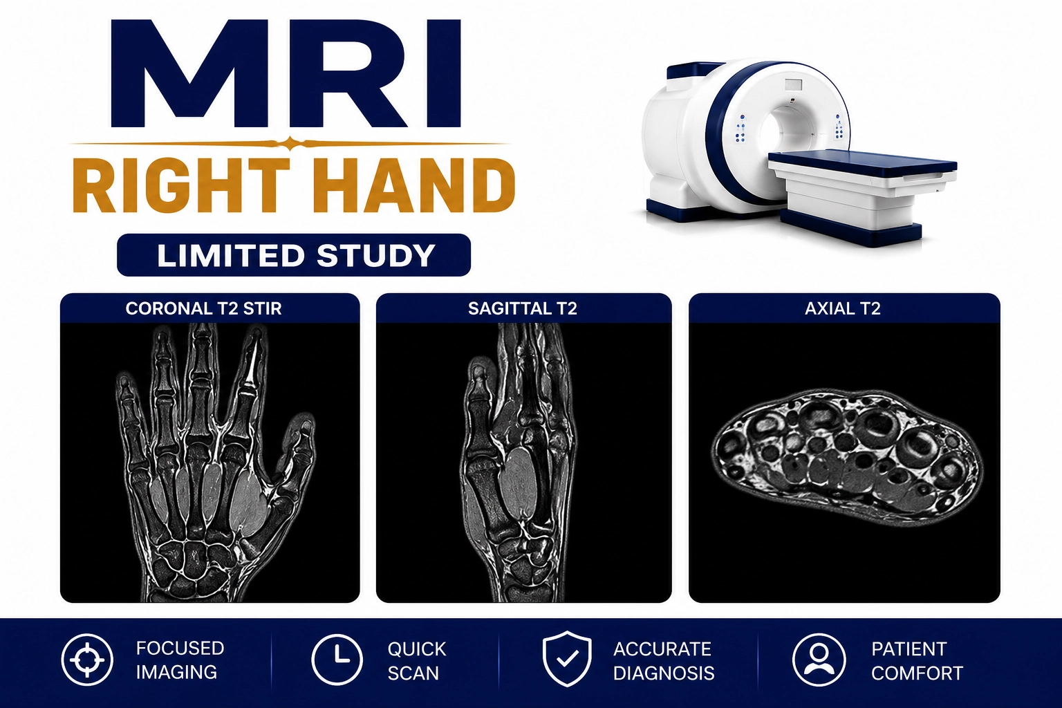 MRI Right Hand scan for evaluation of hand pain, tendon injuries, ligament tears, arthritis, nerve compression, fractures, and soft tissue abnormalities at Focus Diagnostics