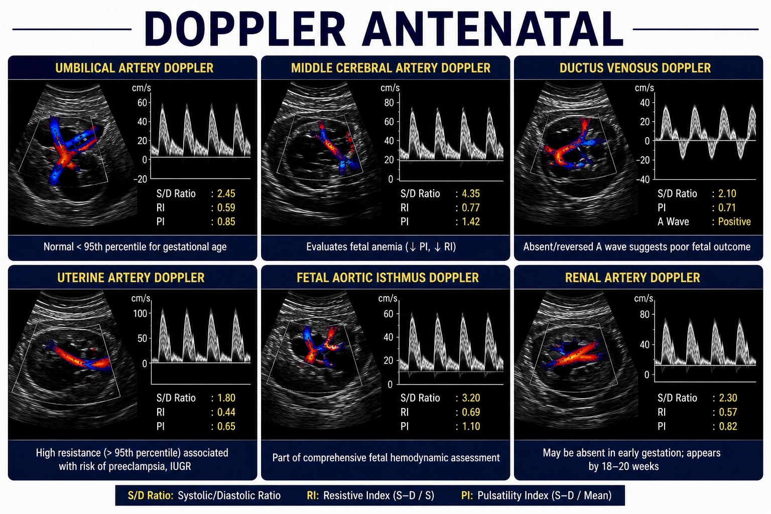 Doppler Antenatal ultrasound for assessment of fetal blood flow, placental circulation, umbilical cord blood supply, and fetal well-being during pregnancy at Focus Diagnostics