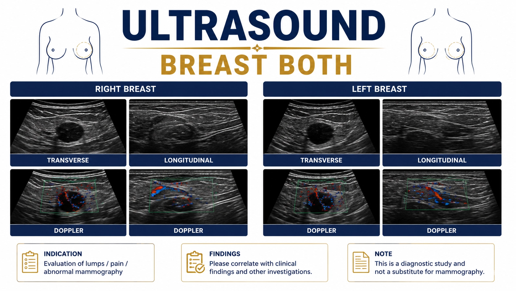 Ultrasound Breast Both scan for evaluation of breast lumps, cysts, breast pain, dense breast tissue, and breast health assessment at Focus Diagnostics
