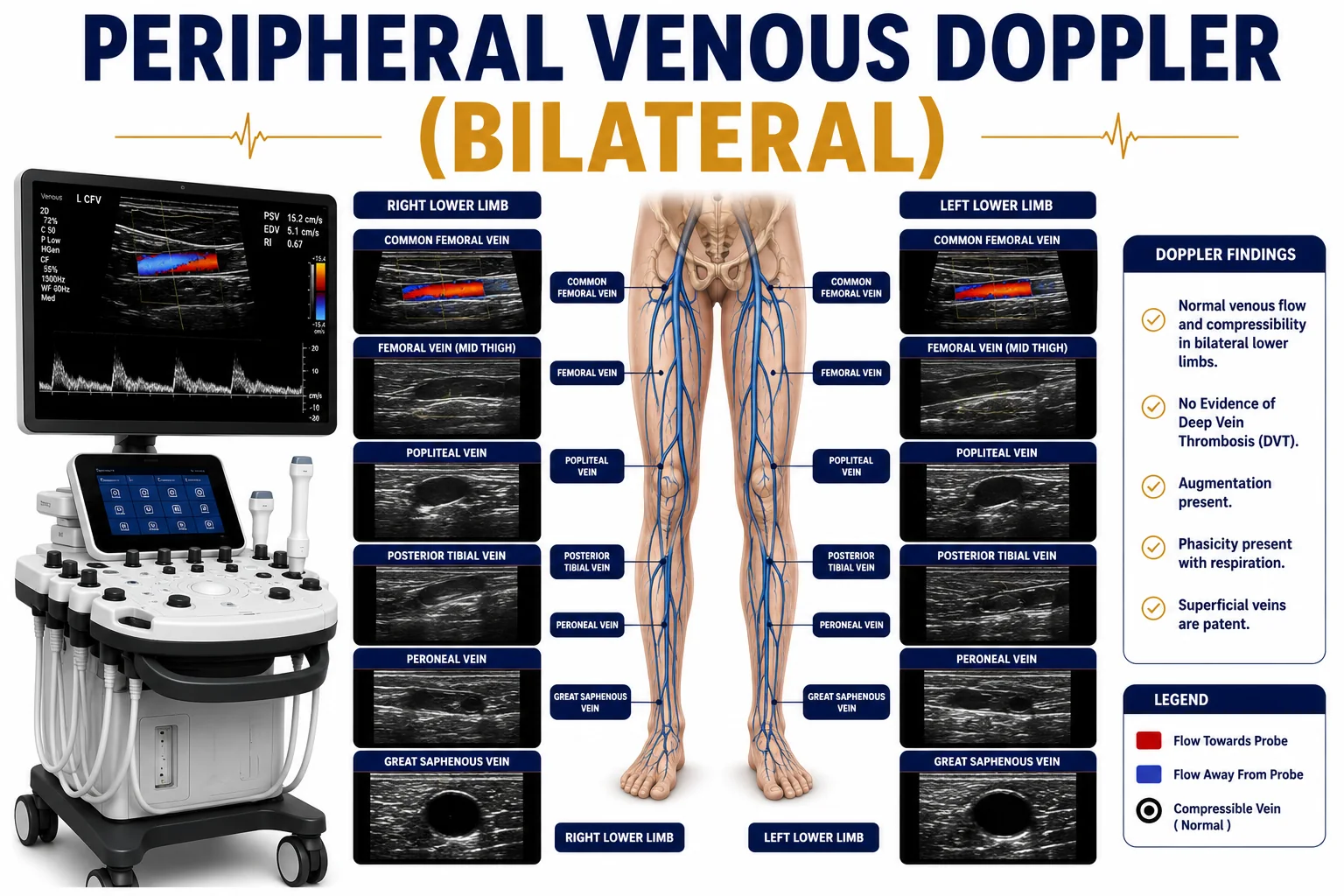 Peripheral Venous Doppler Bilateral ultrasound for evaluation of venous blood flow, deep vein thrombosis, venous insufficiency, varicose veins, and circulation disorders in both limbs at Focus Diagnostics