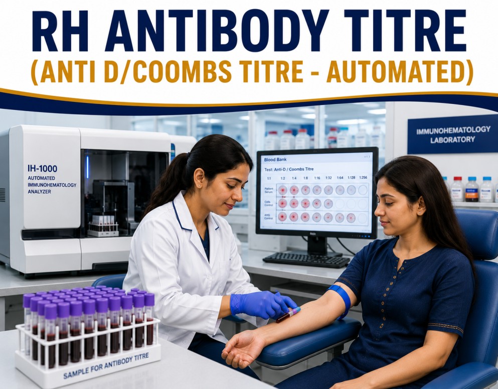 Rh Antibody Titre Anti-D Coombs Titre automated test showing Rh sensitization monitoring and antibody level assessment during pregnancy