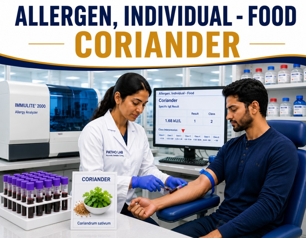Coriander allergy test showing specific IgE antibody analysis for coriander sensitization, spice allergy diagnosis, and food allergy evaluation