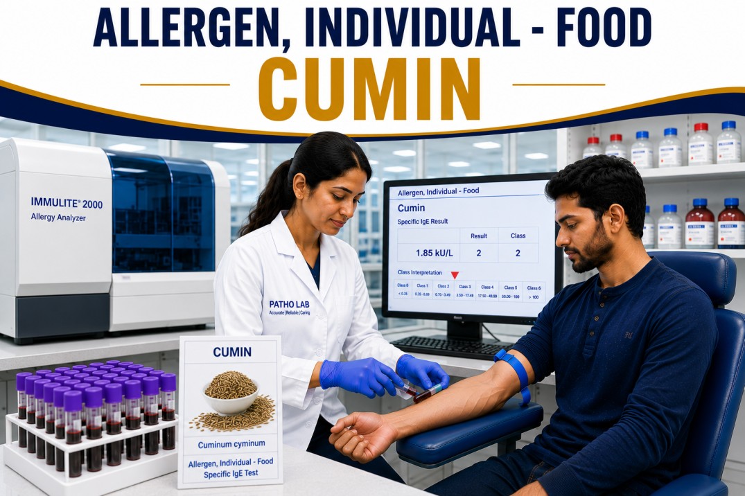 Cumin allergy test showing specific IgE antibody analysis for cumin sensitization, spice allergy diagnosis, and food allergy evaluation