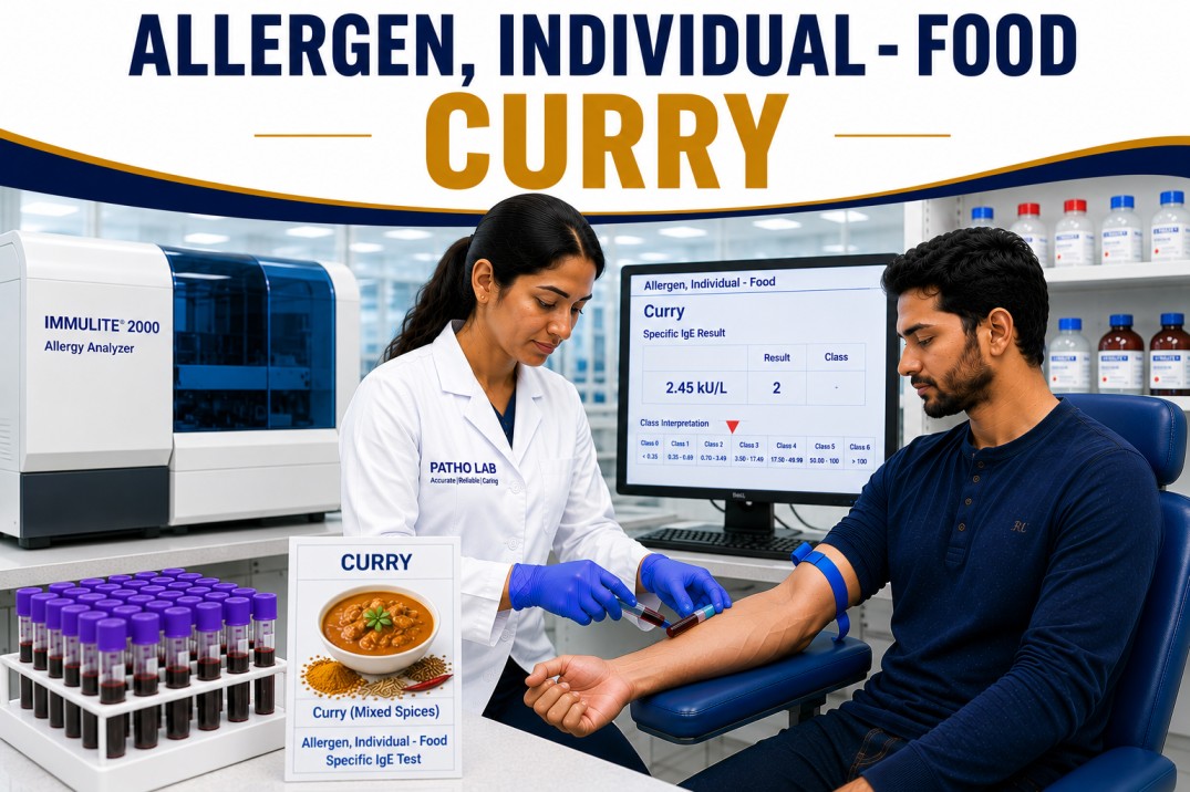 Curry allergy test showing specific IgE antibody analysis for curry spice sensitization, food allergy diagnosis, and spice allergy evaluation