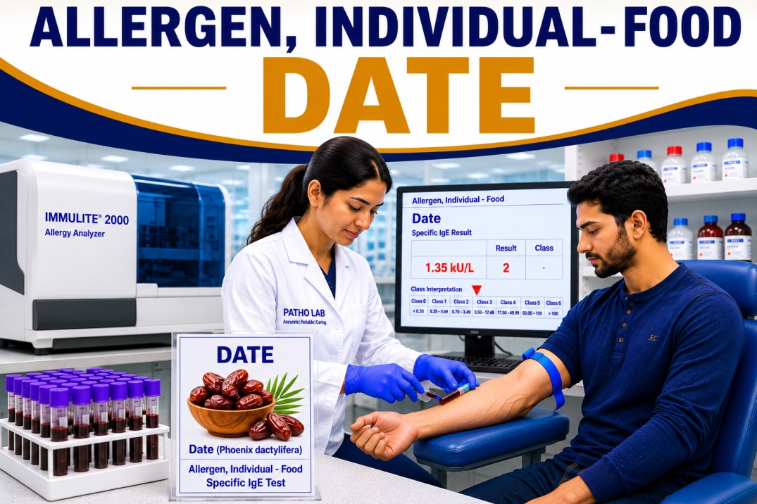 Date fruit allergy test showing specific IgE antibody analysis for date sensitization, food allergy diagnosis, and fruit allergy evaluation