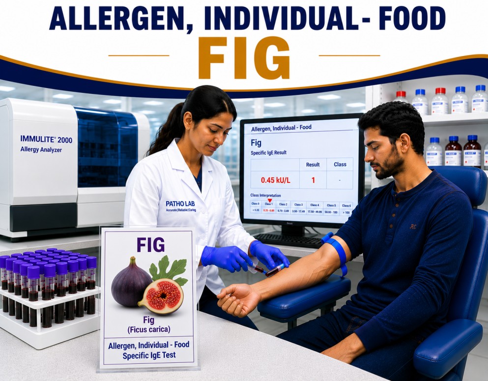 Fig allergy test showing specific IgE antibody analysis for fig fruit sensitization, food allergy diagnosis, and fruit allergy evaluation