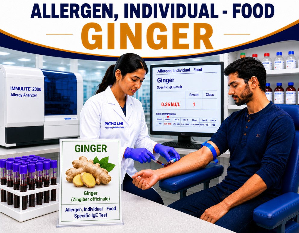 Ginger allergy test showing specific IgE antibody analysis for ginger sensitization, spice allergy diagnosis, and food allergy evaluation